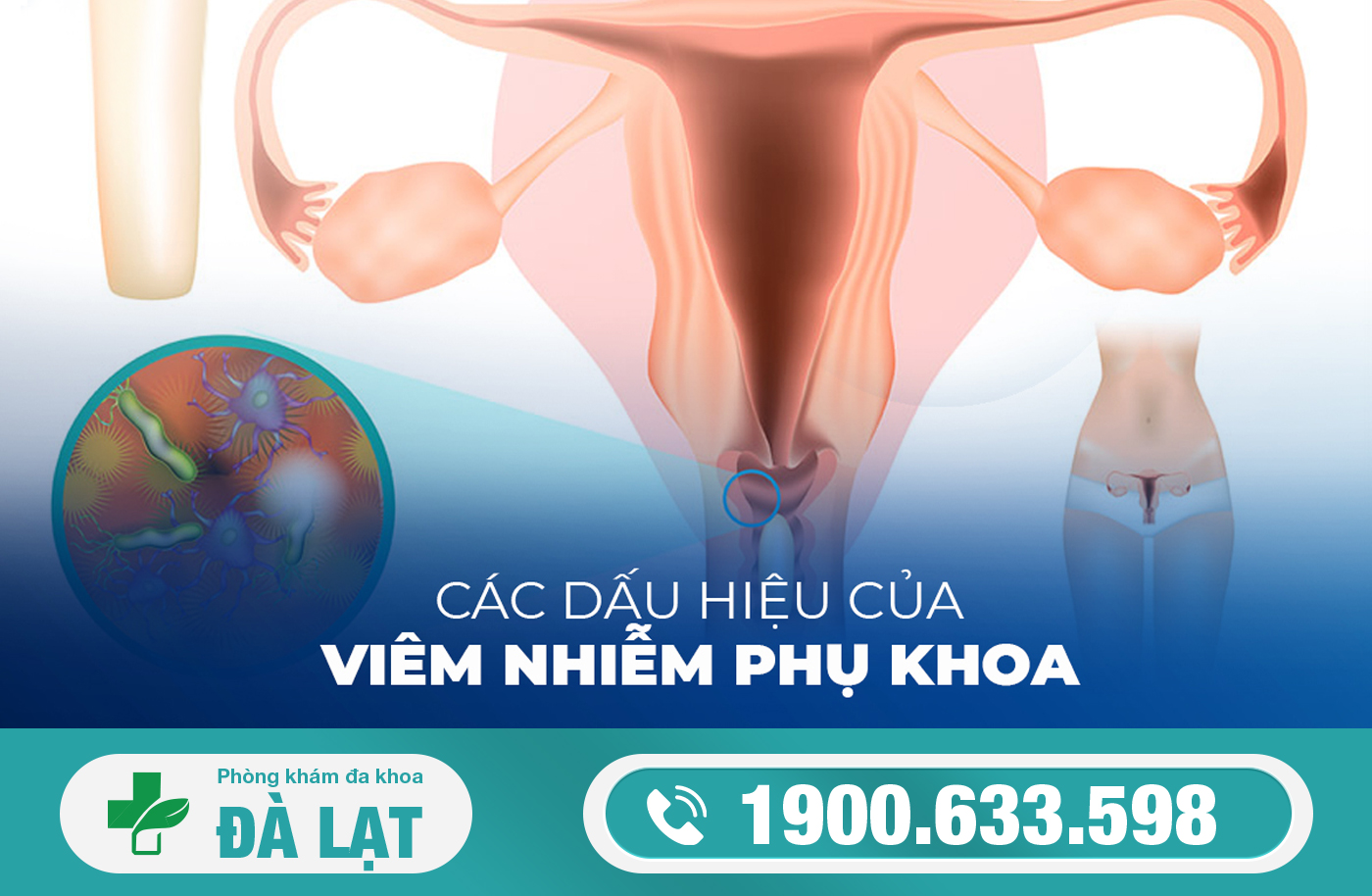 Hình ảnh minh họa